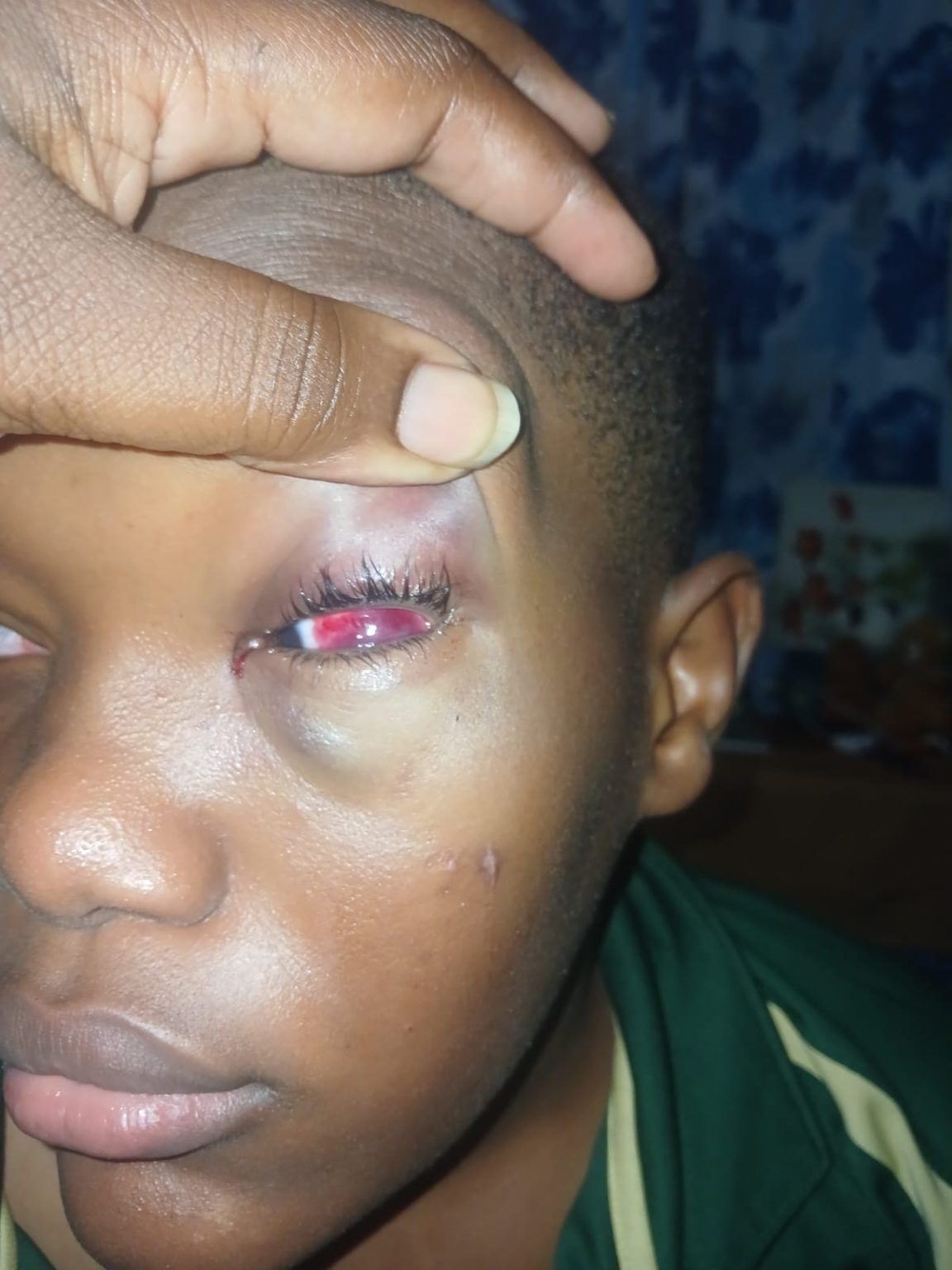 SLBMC issues apology after mother said injured 12-year-old son was ignored for hours in the ER